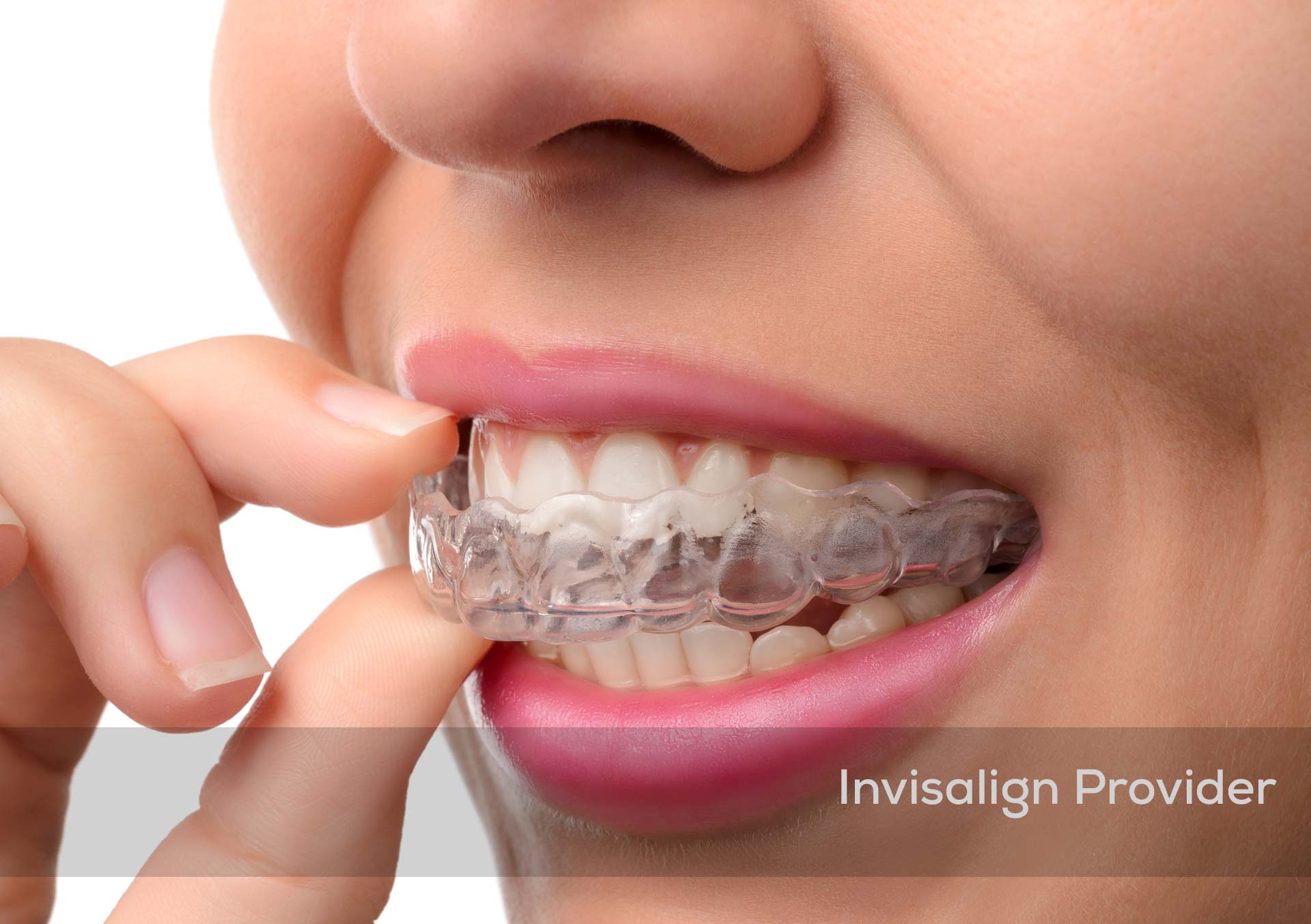 Springmeadows_Invisalign_Provider