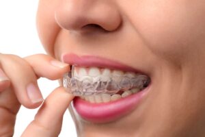 Invisalign Brampton